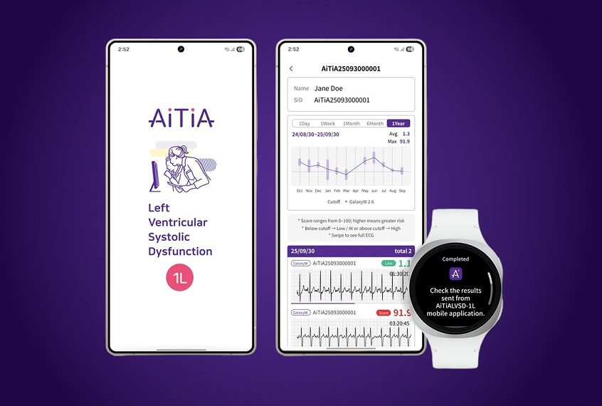 Smartwatch de Samsung detectará afecciones que causan insuficiencia cardíaca